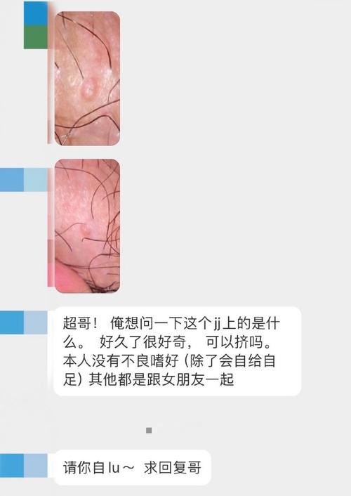 男孩去水上乐园玩水感染传染性软疣,设计策略快速解答_整版DKJ656.74